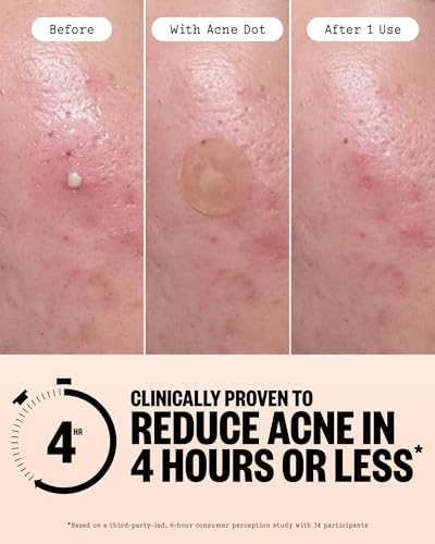 Peace Out Acne Pimple Patches Day & Night Duo (20 Count)