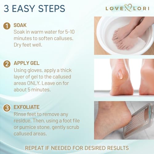 Extra Strength Callus Remover Gel for Feet - 6oz Foot Care