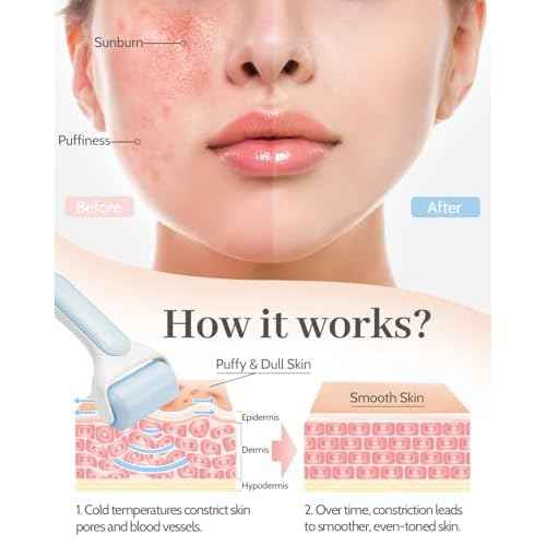 MORGLES Ice Roller for Face, Premium Facial Roller for Puffiness, Dark Circles and Lymphatic Drainage, Cold Face Roller for Women Self Care with Carry Case