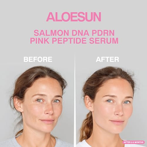 ALOESUN Salmon DNA PDRN Pink Peptide Niacinamide Face Serum - Korean Skin Care - Hydrating Moisturizing Firming Uneven Tone & Dark Spots - Collagen Support Complex - Lightweight Finish - 1.01 Fl Oz