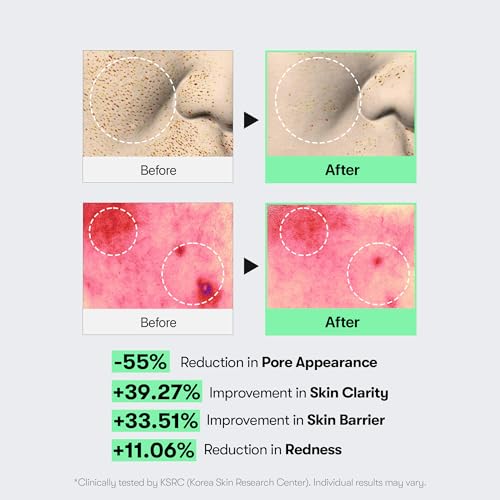 VT CICA Reedle Shot 100 Microneedling Serum 50ml
