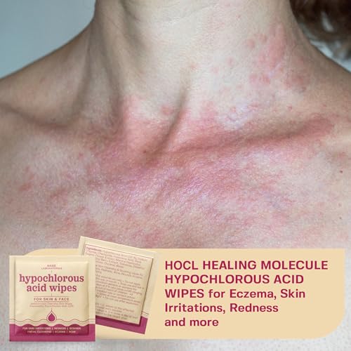 75 Pack Hypochlorous Acid Face & Skin Wipes | Soothing & Cleansing