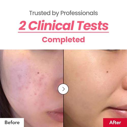 Dark Spot 24% Correcting Pink Glow Cream | Tranexamic Acid 6%, Niacinamide 5%, Dark Spots, Freckle, Blemishes, Pigmentation, Non-Irritating, Korean Skincare, 30ml, 1.01 fl.oz.