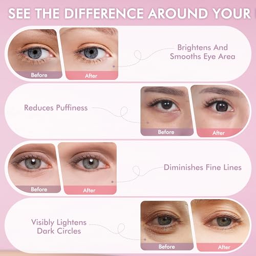 Under Eyes Patches, 40 Pairs Rose Hydrogel Eye Mask for Puffy Eyes and Dark Circles with Rose Essence, Hyaluronic Acid & Niacinamide, Deep Hydrating Eye Treatment for Men & Women