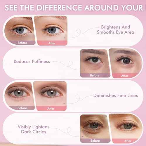 Under Eyes Patches, 40 Pairs Rose Hydrogel Eye Mask for Puffy Eyes and Dark Circles with Rose Essence, Hyaluronic Acid & Niacinamide, Deep Hydrating Eye Treatment for Men & Women