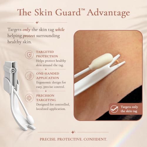 Skin Clinic Freeze 'n Clear Cryogenic Skin Tag Removal Kit with Post-Treatment Serum