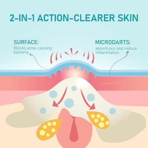 36 Count Pimple Patches Microdart, Zit Patches with Microdart Technology, Salicylic Acid, Sodium Hyaluronate, Centella Extract, Acne Patch for Blemishes, Zits