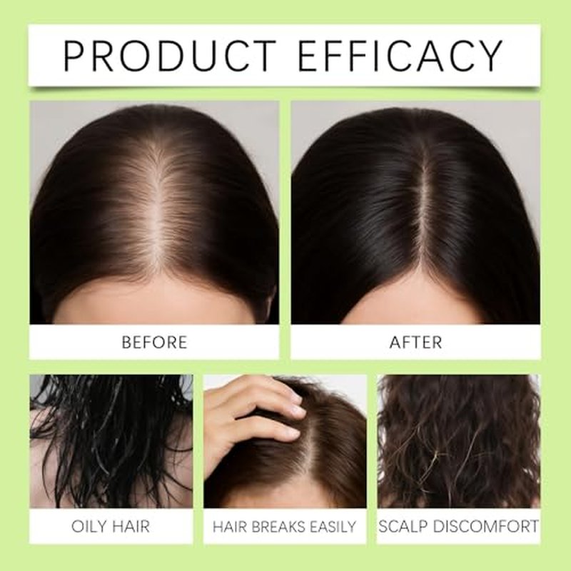 Hair Regrowth Serum for Men & Women - Biotin & Ginseng