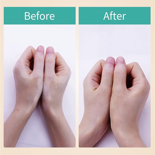 Instant Age Rewind Eraser Multi-Use Concealer Stick for Vitiligo, Scars, Dark Circles, Blemishes, and Stretch Marks ? Natural Shade, Waterproof & Long-Lasting (natural, 7g)