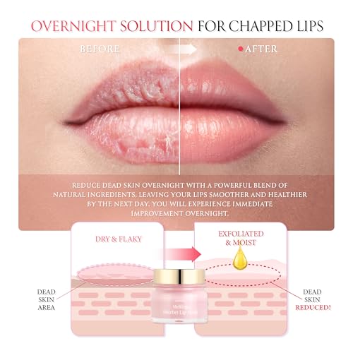 FORENCOS Melting Sherbet Lip Mask, Overnight Treatment with Manuka Honey, Olive Oil & Vitamin E, Sleeping Mask & Repair Moisturizer for Dry, Cracked Lips, Nourishing Care, 0.7 oz