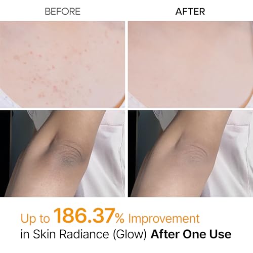 Dr.Melaxin Kojic Acid Turmeric Body Exfoliator Spray 6.76oz