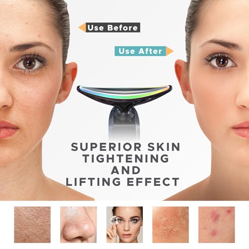 Facial Neck Massager with Heat & LED - 1000 Vibrations, 30-Day Battery