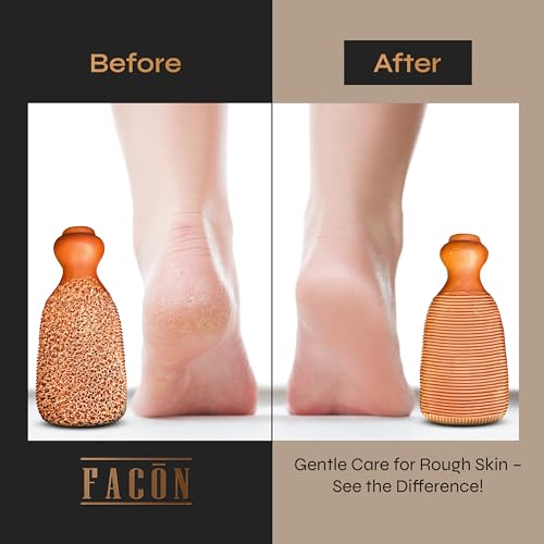 Facón Terracotta Pumice Stone - 2-Sided Foot Callus Remover & Scrubber