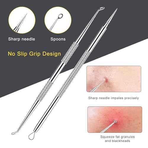 Pimple Popper Tool Kit - Boxoyx 10 Pcs Blackhead Remover Comedone Extractor Kit with Metal Case for Quick and Easy Removal of Pimples, Blackheads, Zit Removing, Forehead,Facial and Nose(All Silver)