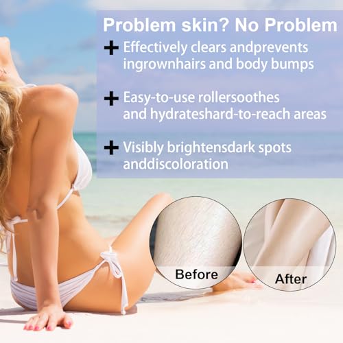 Bettenko Ingrown Hair Serum for Smooth, Clear Skin - Gentle & Fast-Absorbing