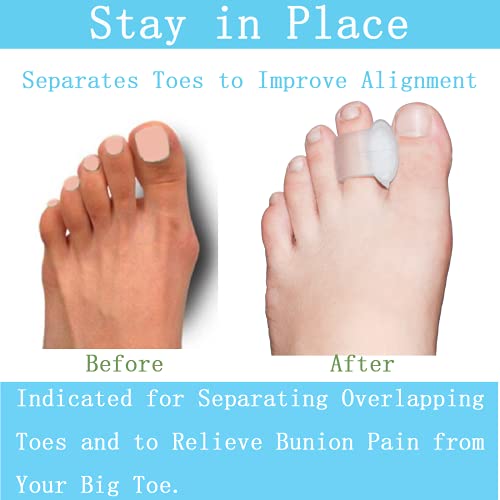 MENOCADY Clear Gel Toe Separator Pack of 12 - Big Toe Spacers for Bunions, Overlapping Toes, and Toe Corrector (1/4" Thick)