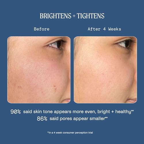 Kinship Dream Wave 2% Bio-Retinoid Overnight Ultra Hydrating Serum for Face | Retinol for Sensitive Skin | Anti Aging Niacinamide + Tranexamic Acid | Smooth Wrinkles | Redness Reducing Skin Care 1 Oz