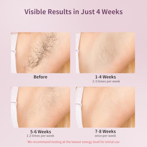 IPL Laser Hair Removal Device for Long-Term Hair Reduction - Ice Cooling Technology