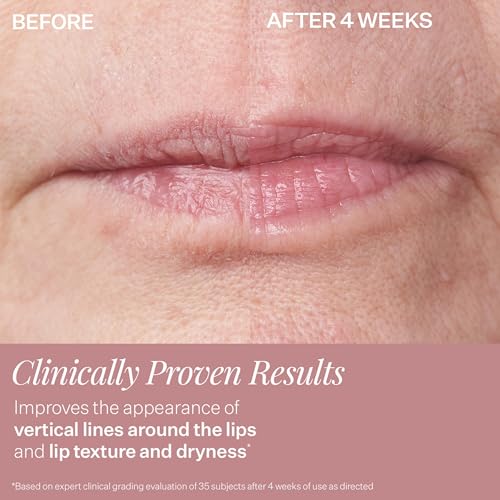 StriVectin Anti-Wrinkle Eye Cream Concentrate