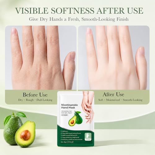 Avocado Moisturizing Hand Mask Gloves, 5 Pairs - Hydrating Hand Care