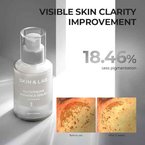 [SKIN&LAB] Gluthathione Radiance Serum with Niacinamide and Alpha-Bisabolol, Even Skin Tone, Brighten Dark Spot and Hyperpigmentation?, Korean Skincare for Uneven Tone, 1.01 Fl. Oz