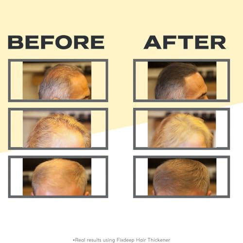Hair Thickener Fibers - Waterproof Formula Dark Brown 14g