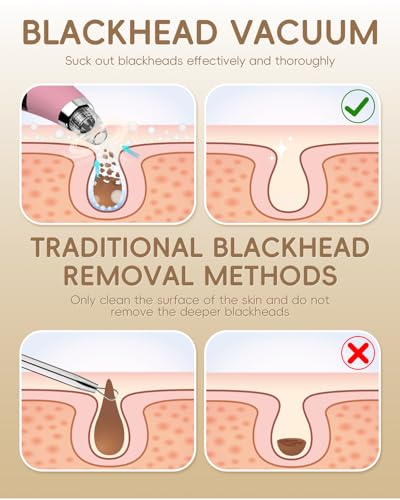 Pore Vacuum Blackhead Remover - 5 Attachments & 3 Suction Levels