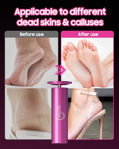Electric Foot Callus Remover - Professional Pedicure File with 60 Discs