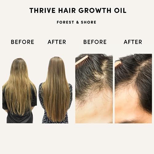 Forest & Shore Thrive Hair Growth Oil - Natural Hair Serum for Damaged Hair, Caffeine, Biotin & Argan, 100ml