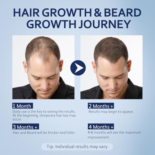 5% Minoxidil Hair Growth Serum with Biotin - Extra Strength for Men & Women