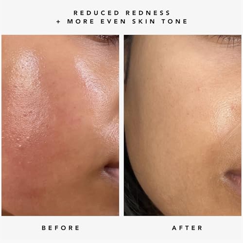 HERBIVORE Nova 15% Vitamin C + Turmeric Brightening Serum for Dark Spots, Hyperpigmentation + Even Skin Tone | Vegan, Plant-Based, Cruelty-Free, 30 mL / 1 oz