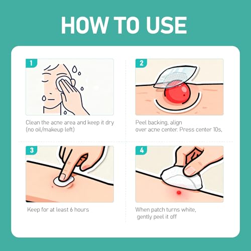 36 Count Pimple Patches Microdart, Zit Patches with Microdart Technology, Salicylic Acid, Sodium Hyaluronate, Centella Extract, Acne Patch for Blemishes, Zits