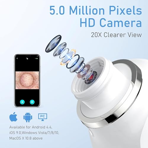 Blackhead Remover Vacuum with HD Camera & 6 Suction Heads