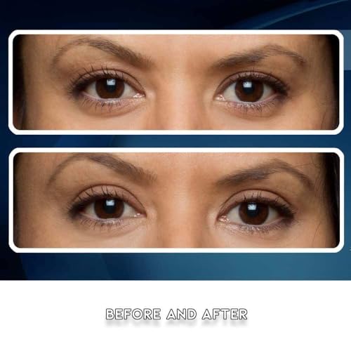 Eye Magic Premium Eye Lift Strips - 80 Count Medium