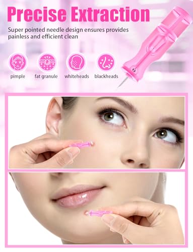 Disposable Facial Extraction Lancets - Pink 50Pcs for Acne Blackhead Removal