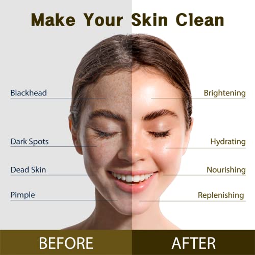 Purederm Vegan Facial Sheet Masks Trio (12 Packs) ? Face Masks Skincare for Dry, Dehydrated and Dull Skin