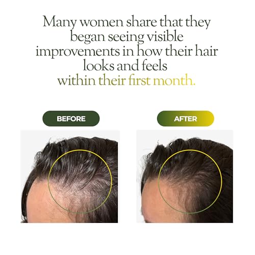 regener8 Hair & Scalp Oil for Women – Essential Carrier Blend