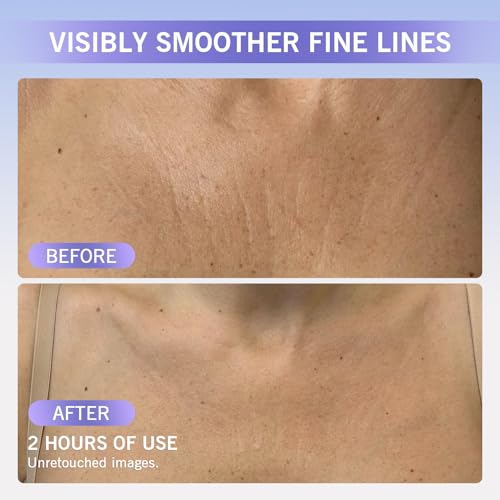Forehead Wrinkle Patches ? Anti Wrinkle Silicone Pads for Fine Line Remover, Reusable Face, Neck & Chest Decollete Patches for Women, Overnight Anti Aging Wrinkles Patches for Sensitive Skin, 6 Pack