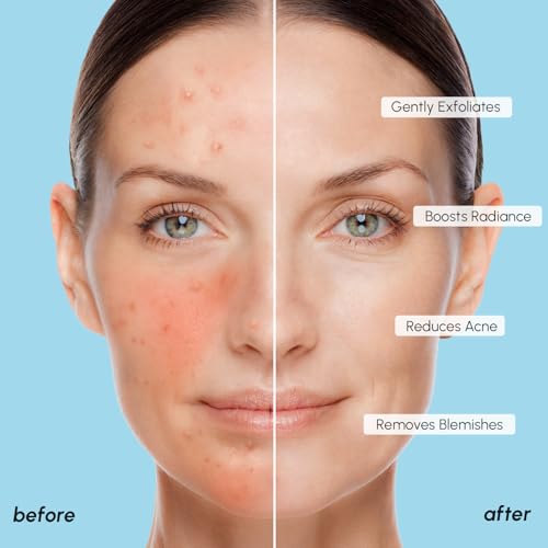 MAREE Glycolic Acid Polishes 2 PACK - Toner Polishes for Face Cleansing - Tea Tree Oil, Salicylic Acid & Vitamins E, B3, B5 - Facial Peel & Radiance Deep Cleaning Effect