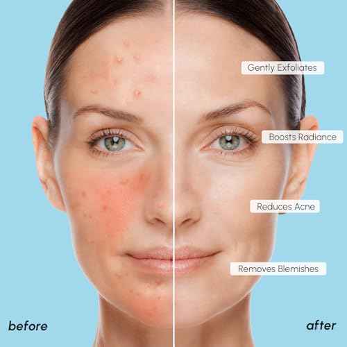 MAREE Glycolic Acid Pads - Toner Pads for Face Cleansing - Exfoliating Pad with Tea Tree Oil, Salicylic Acid & Vitamins E, B3, B5 - Acne Clearing, Skin Pore Resurfacing & Radiance Device - 50 Count