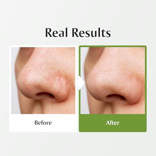 [Redence] Green Grape 3-in-1 Gelato Pore Mask Cleanser, Pore Exfoliating Scrub Mud Mask, No Tightness, Korean Skin Care, 100ml / 3.38 fl oz