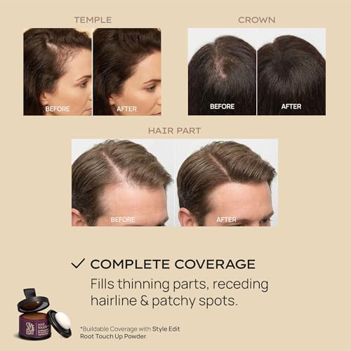 Hair Building Fibers Dark Brown 0.88oz - Fuller Thicker Hair