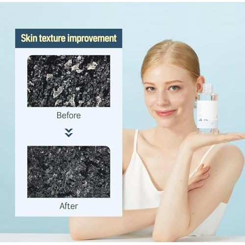 Round LAB 1025 Dokdo Toner + Dokdo Lotion Set | Gentle Exfoliating Dead Skin Cells Without Irritation, Hydrating, Watery Type Toner, Lotion, for Sensitive Skin (6.76fl.oz)
