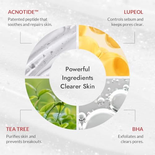 MIZON Good Bye Blemish Low pH Cleanser, Cleanser for troubled skin, Acne Treatment, Breakout Treatment, Korean Skincare, Acne Spot Treatment, Soothing for sensitive skin(100ml 3.38 fl oz)