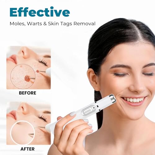 Blue Light Therapy Pen for Acne, Scars, and Skin Tightening