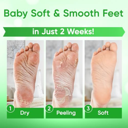 CÉLOR Foot Peel Mask for Dead Skin & Callus Removal - Aloe Vera & Nourishing Ingredients, 2 Pairs