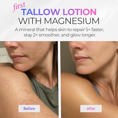Beef Tallow Body Lotion with Magnesium & Shea Butter - Lightweight, Fast-Absorbing Body Cream with Avocado Oil & Vitamin E - Non-Greasy Moisturizer for Dry, Sensitive Skin - Daily Hydration, 4oz
