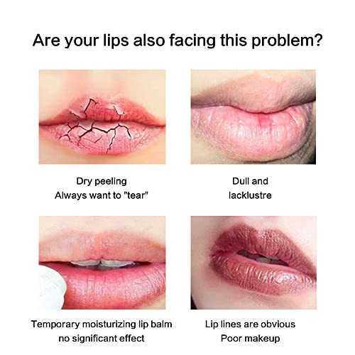 Lip Collagen with Peptide & Stem Cell Complex, Lip Balm for Dry Lips, a Lip Moisturizer for Lip Care and Lip Treatment
