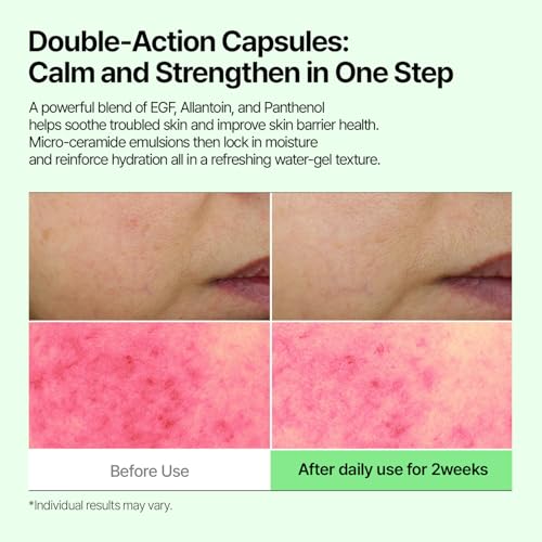 EGF Allantenol Repair Ampoule, Hydrating and Barrier Support, Centella Asiatica, Hyaluronic Acid & Ceramides, Soothing Ampoule for Sensitive Skin, Brightening Recovery Serum, 1.01 fl oz