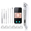 HD Camera Blackhead Remover Vacuum with LED Lighting - 3 Modes, 6 Suction Heads, Smartphone App